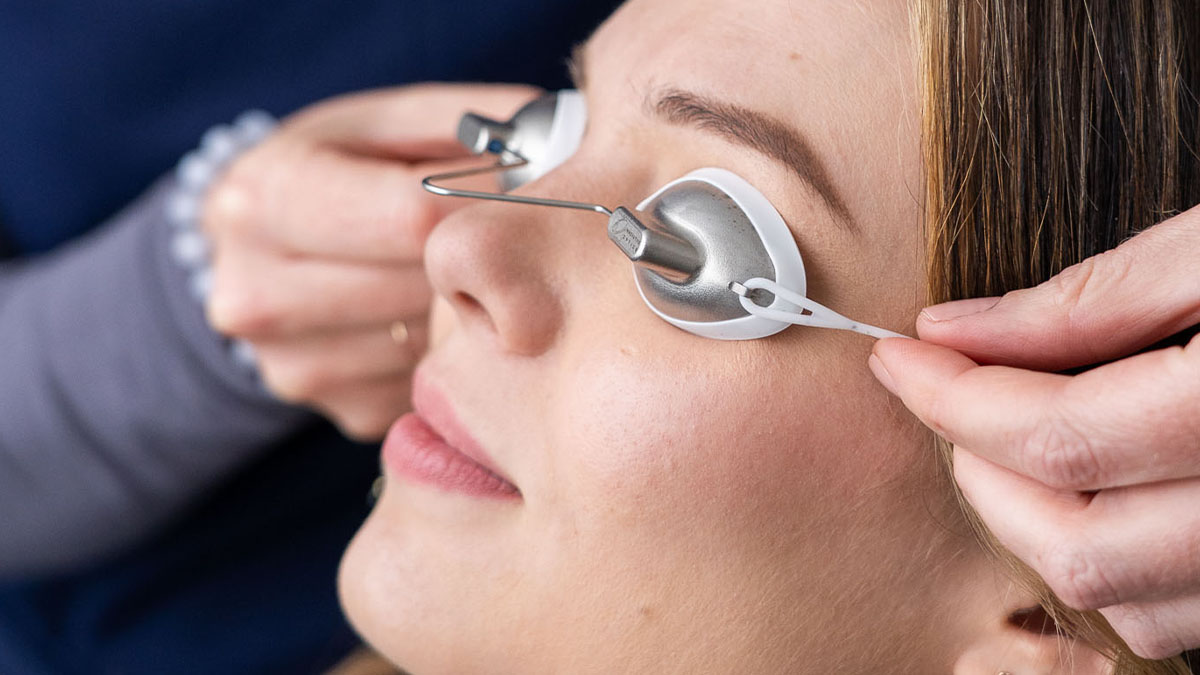 Excel V+ laser treatment at DERM Lab in North Vancouver. Reduces redness and improves skin tone